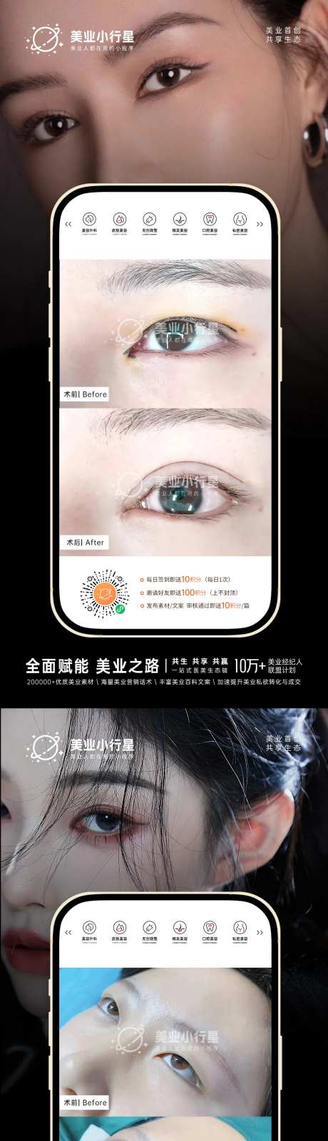 医美整形美容真人案例分享海报-采灵感-https://www.cailinggan.com/