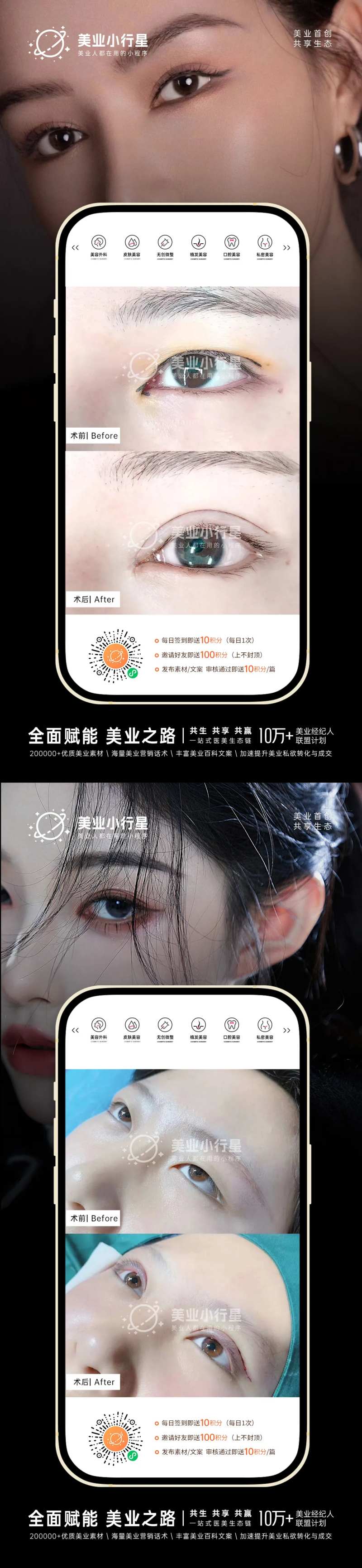 医美整形美容真人案例分享海报-采灵感-cailinggan.com