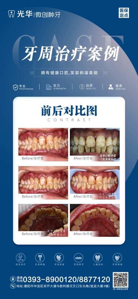 口腔治疗案例对比海报-采灵感-https://www.cailinggan.com/