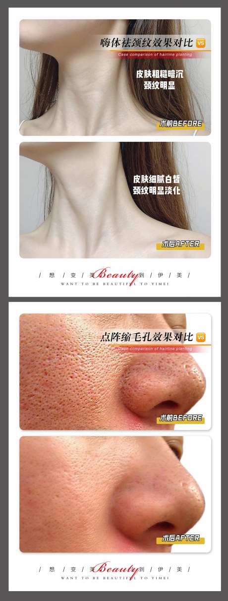 医美案例模板-采灵感-https://www.cailinggan.com/