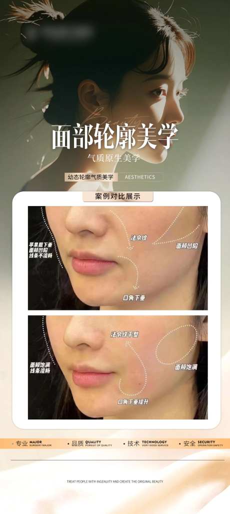 医美外轮廓填充案例-采灵感-https://www.cailinggan.com/