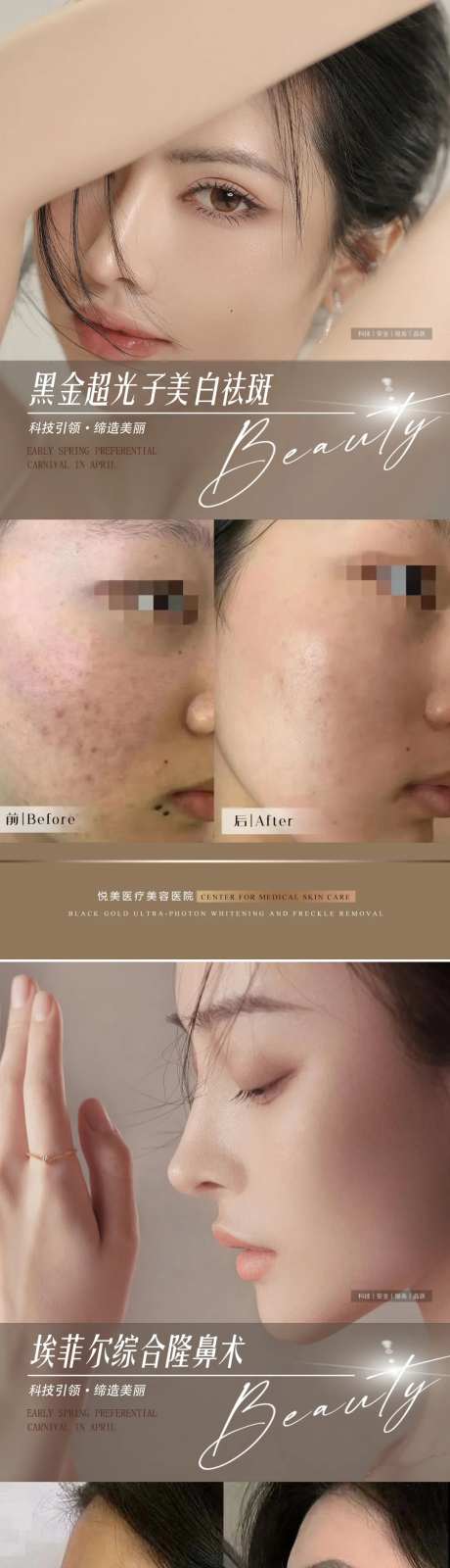 医美隆鼻祛斑案例对比海报-采灵感-https://www.cailinggan.com/