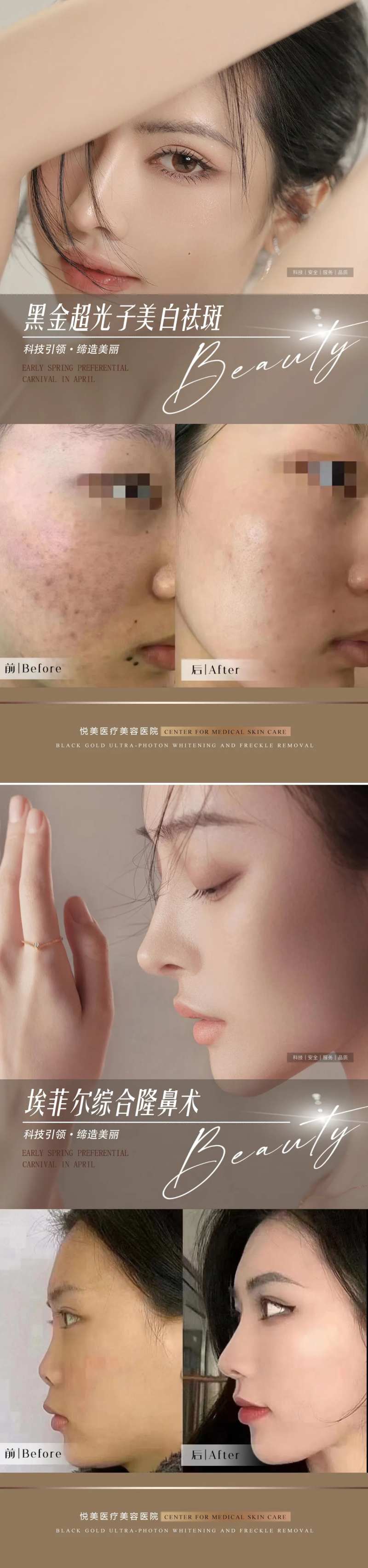 医美隆鼻祛斑案例对比海报-采灵感-cailinggan.com