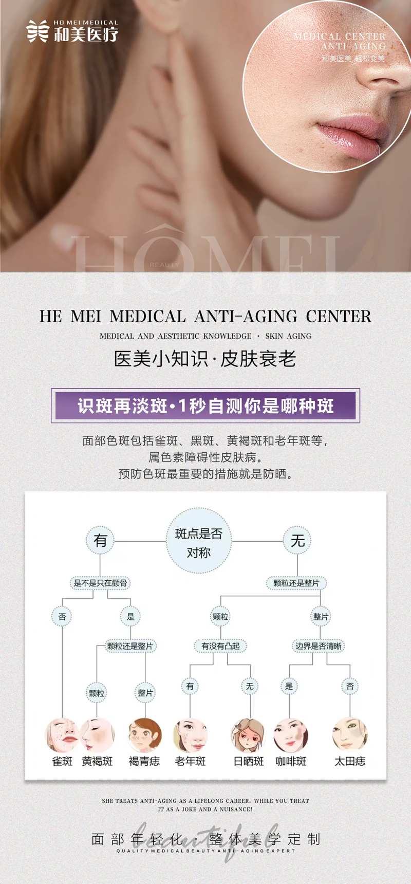 识斑再淡斑·1秒自测你是哪种斑-采灵感-cailinggan.com