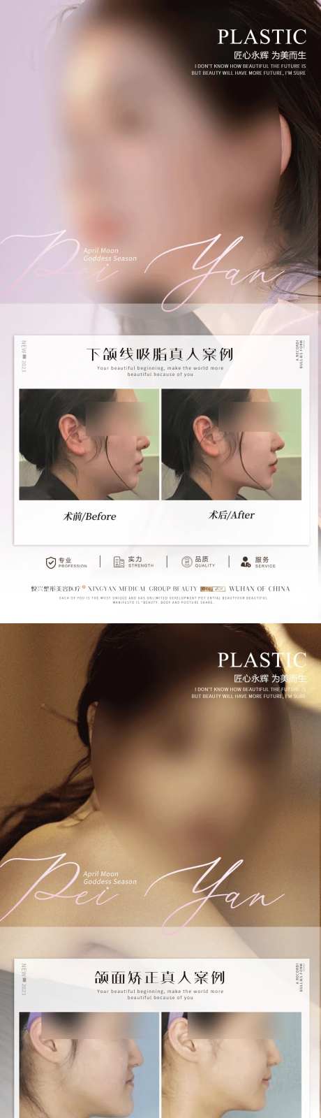 整形真人案例分享集-采灵感-https://www.cailinggan.com/