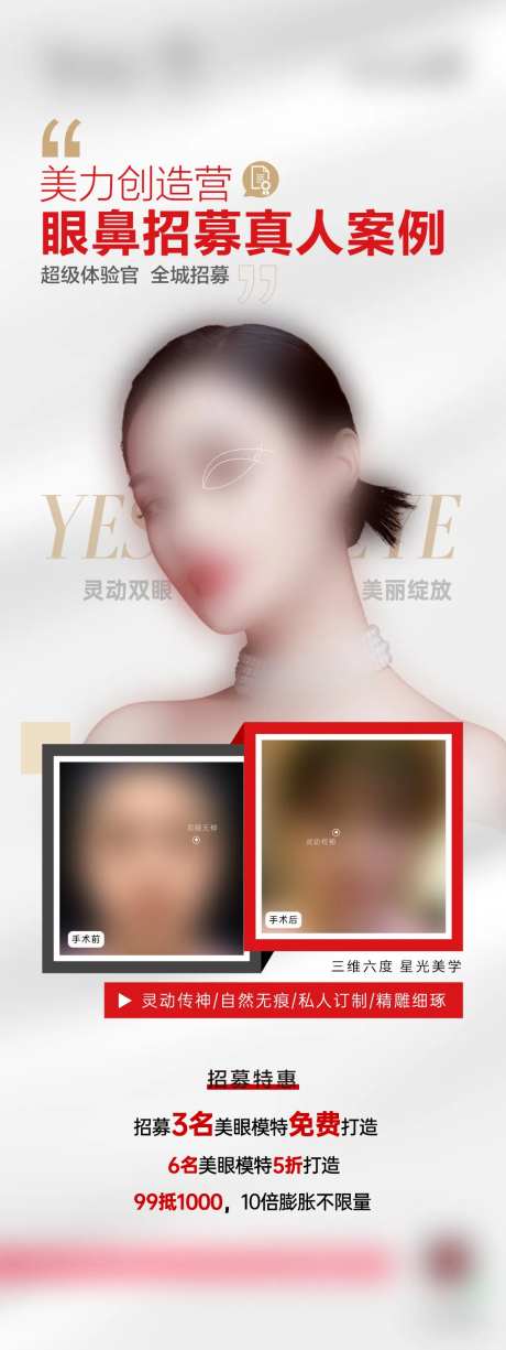 医美整形双眼皮案例招募海报-采灵感-https://www.cailinggan.com/