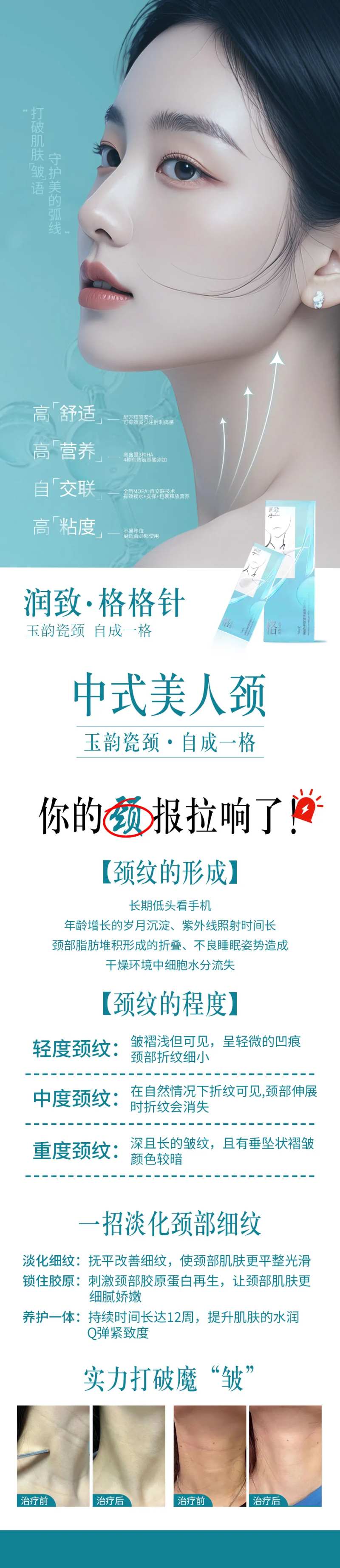 润致格格针海报-采灵感-cailinggan.com