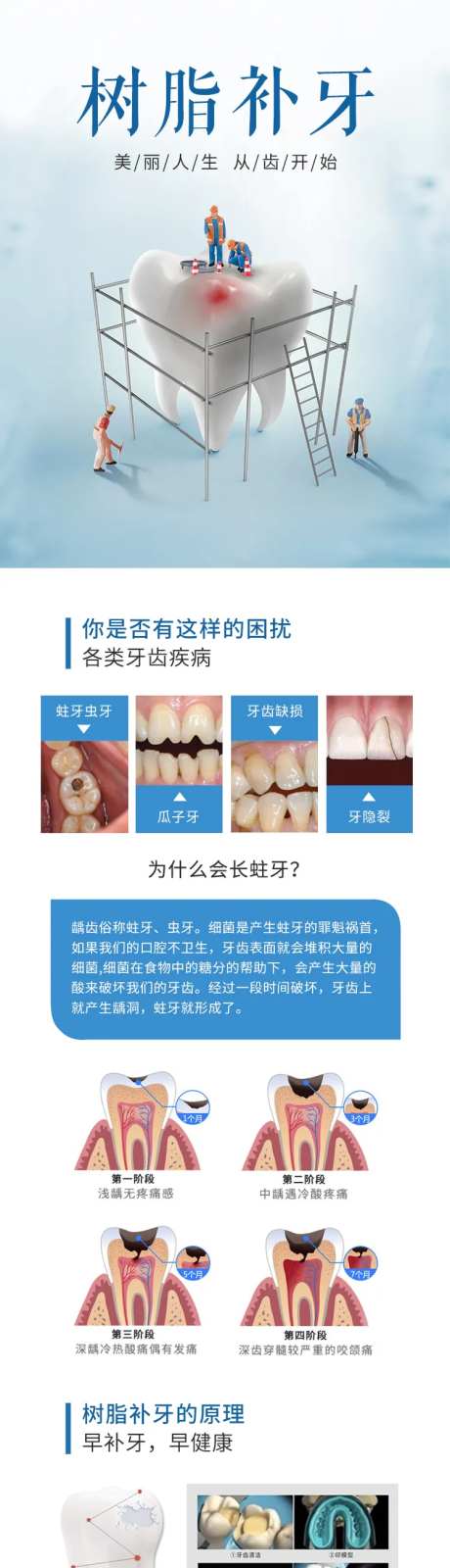 树脂补牙-采灵感-https://www.cailinggan.com/