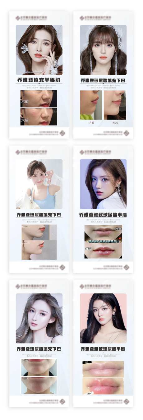 医美玻尿酸填充案例对比海报-采灵感-https://www.cailinggan.com/