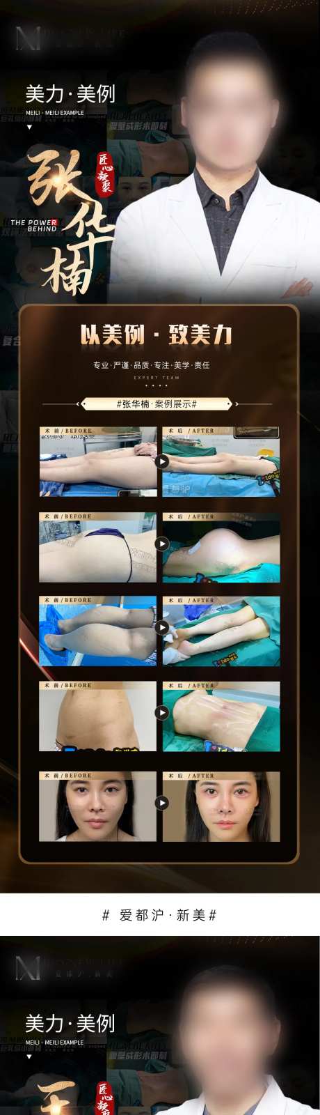 医美专家案例简介海报-采灵感-https://www.cailinggan.com/