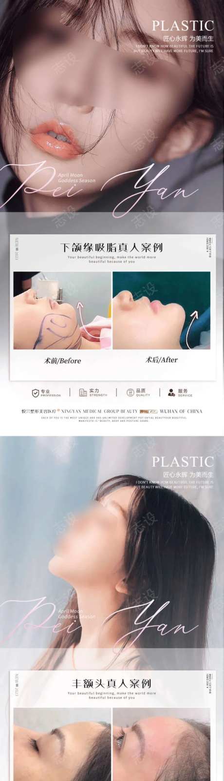 医美真人案例案例对比 真人整形案例集-采灵感-https://www.cailinggan.com/