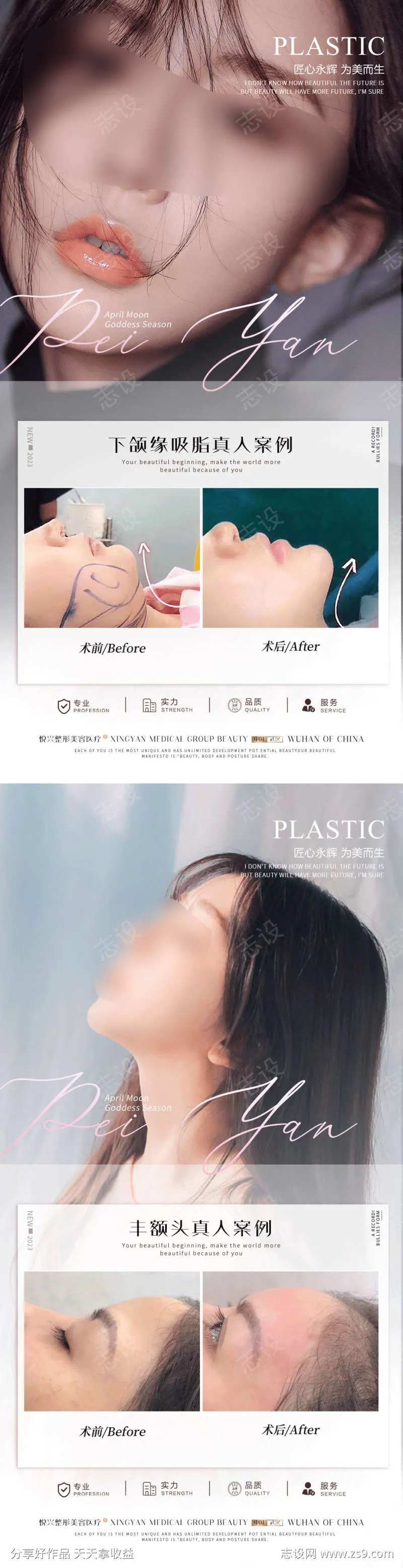 医美真人案例案例对比 真人整形案例集-采灵感-cailinggan.com