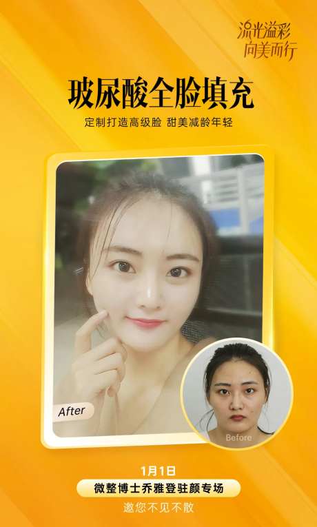 医美乔雅登案例图-采灵感-https://www.cailinggan.com/