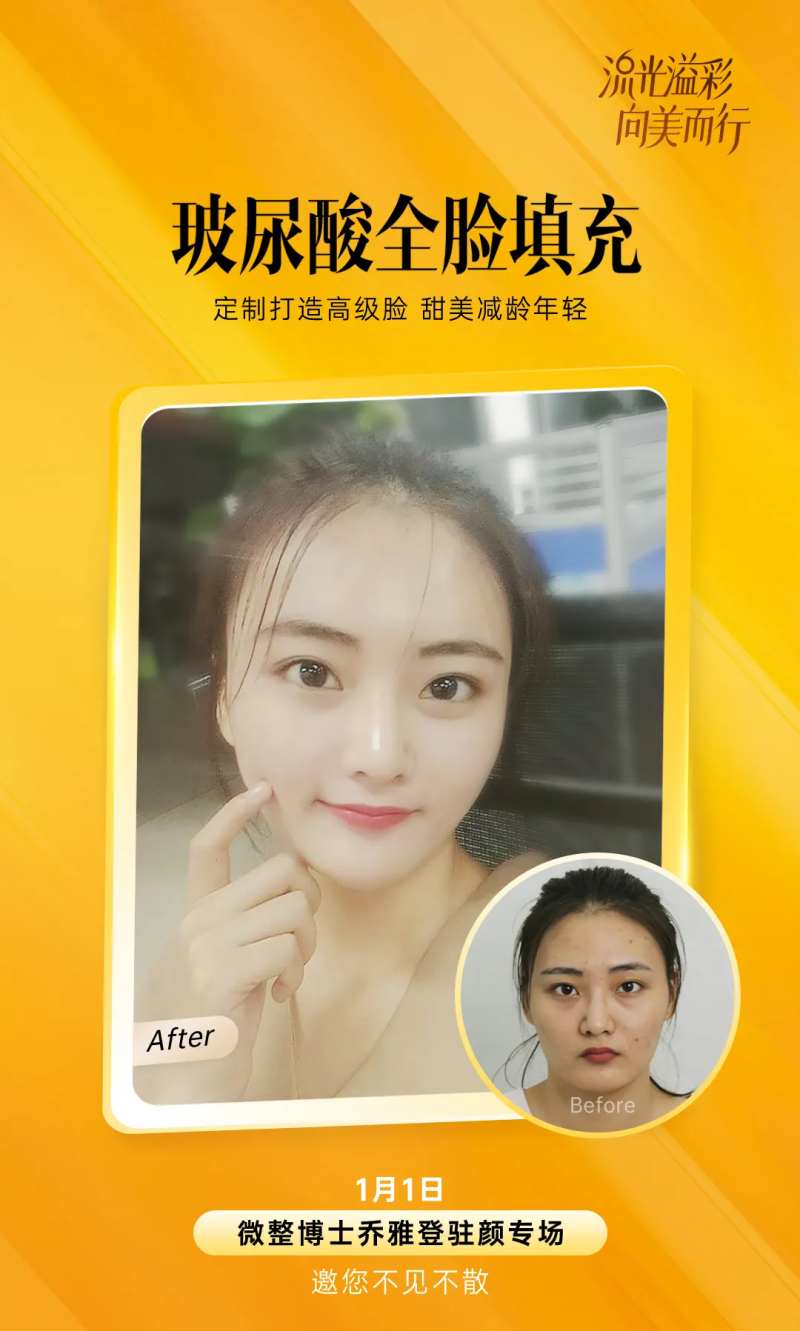 医美乔雅登案例图-采灵感-cailinggan.com