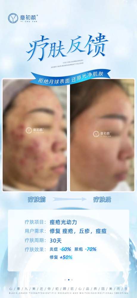 医美祛斑对比简约海报-采灵感-https://www.cailinggan.com/