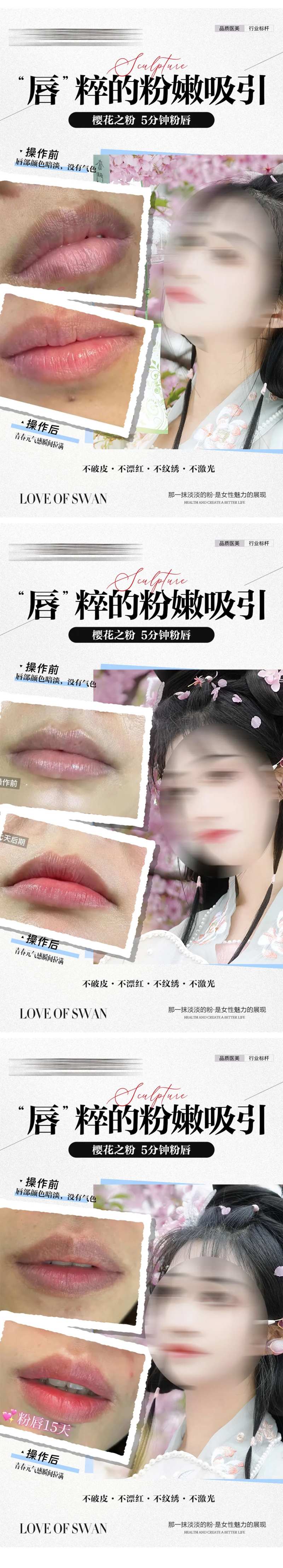 私密粉嫩案例对比海报-采灵感-cailinggan.com