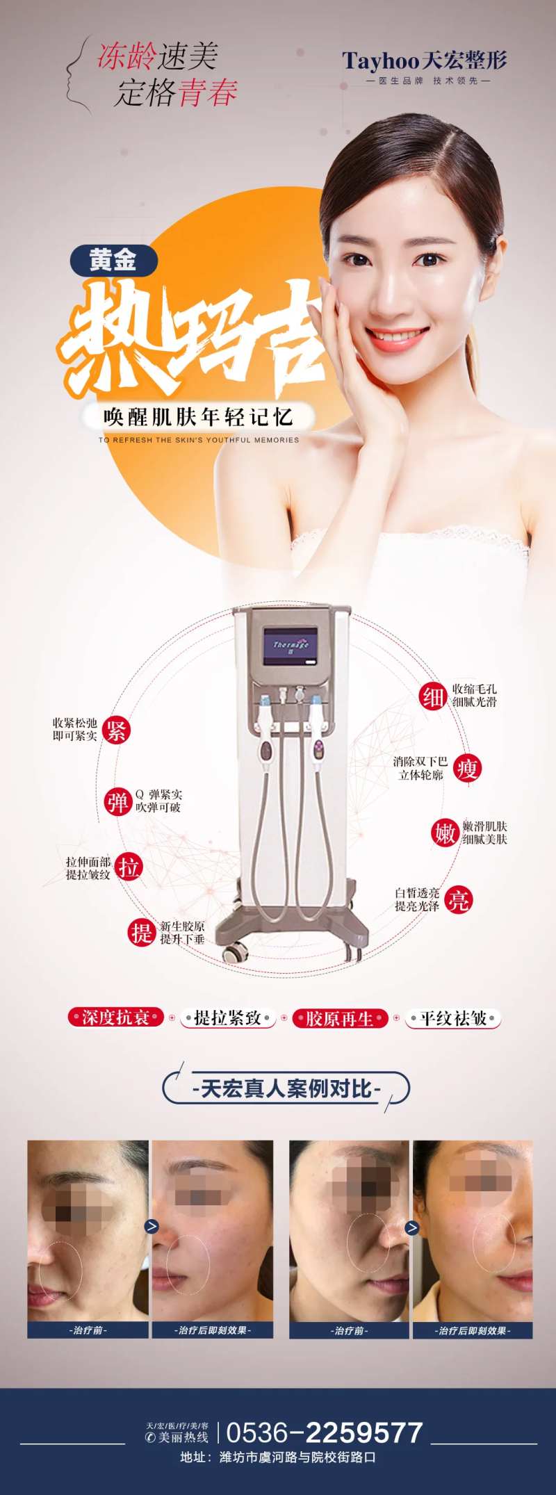 热玛吉-采灵感-cailinggan.com