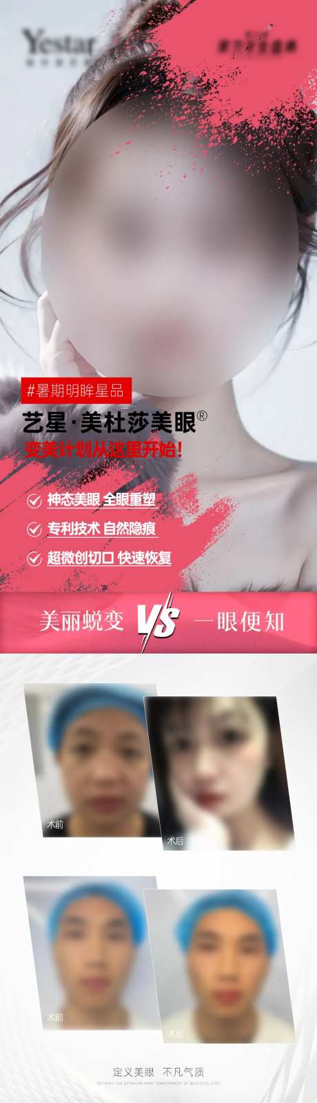 医美双眼皮整外美眼项目案例对比-采灵感-https://www.cailinggan.com/