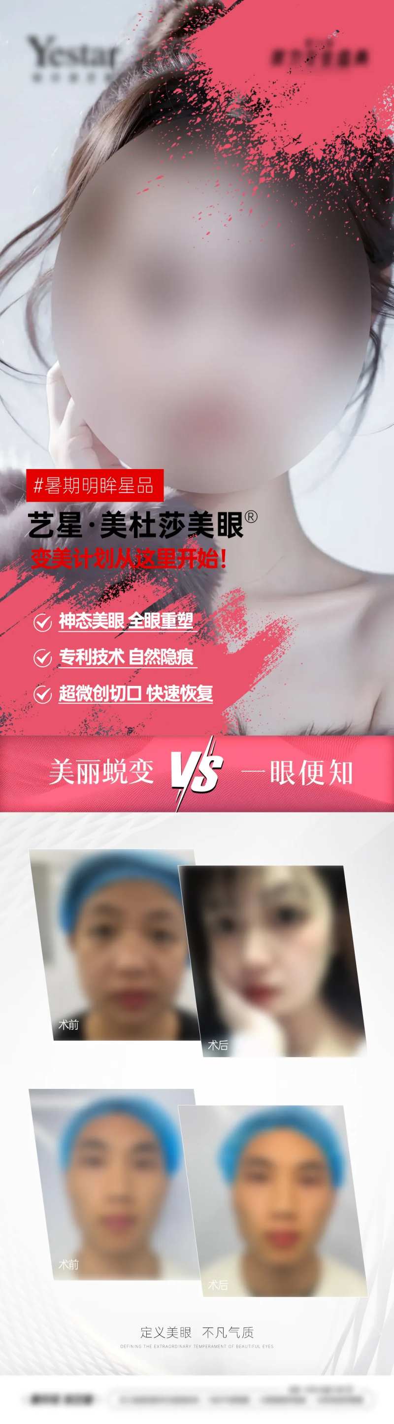 医美双眼皮整外美眼项目案例对比-采灵感-cailinggan.com