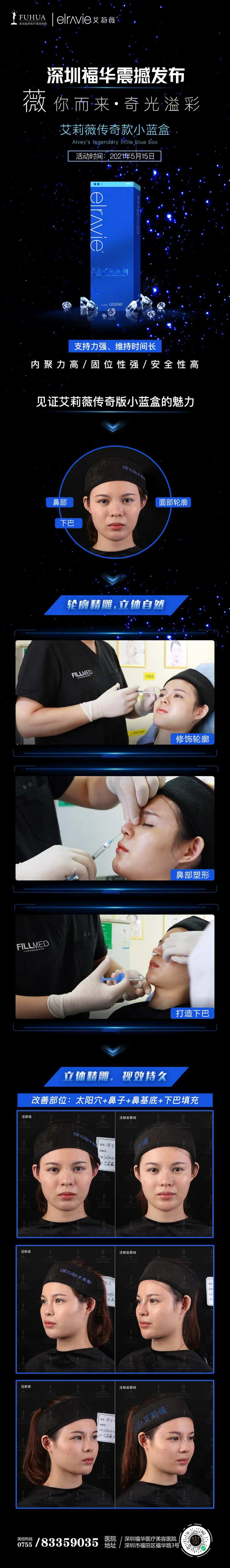 医美艾莉薇长图案例-采灵感-cailinggan.com