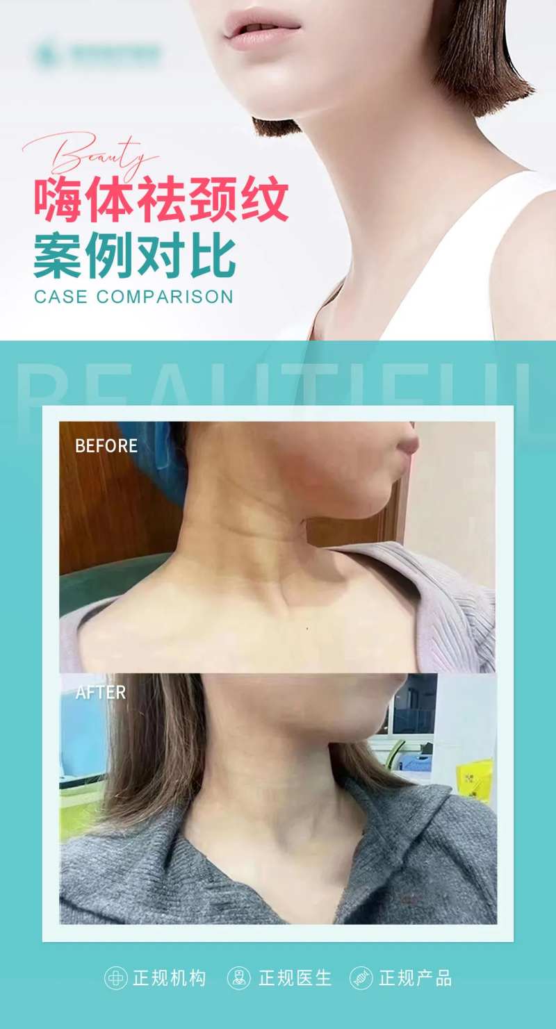 医美祛颈纹案例-采灵感-cailinggan.com