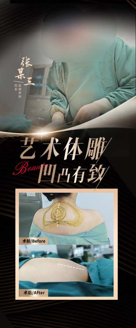 富贵包吸脂-采灵感-https://www.cailinggan.com/