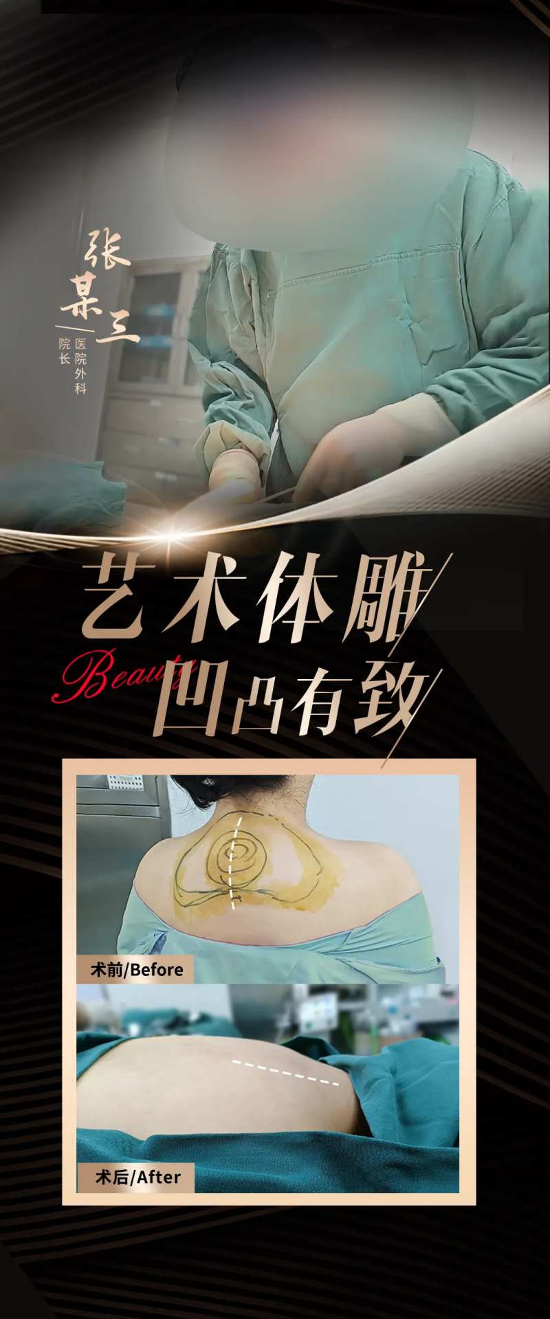 富贵包吸脂-采灵感-cailinggan.com