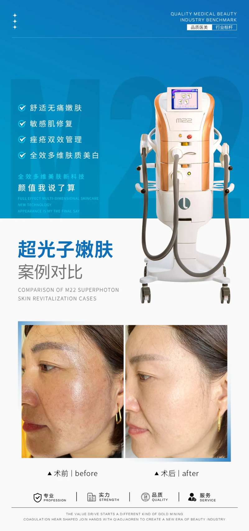 M22光子嫩肤案例海报-采灵感-cailinggan.com