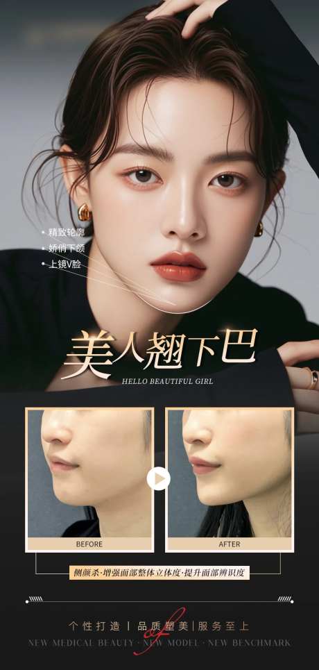 医美下巴填充案例海报-采灵感-https://www.cailinggan.com/