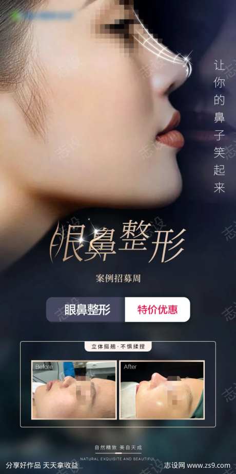 眼部鼻部整形-采灵感-https://www.cailinggan.com/