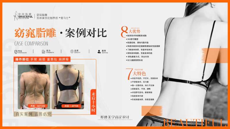 窈窕脂雕案例对比-采灵感-cailinggan.com