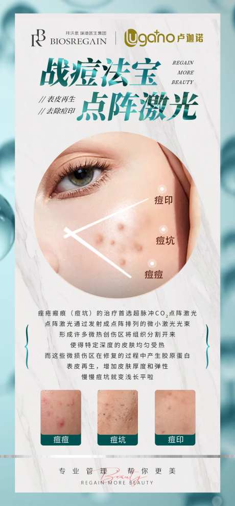 点阵激光-采灵感-https://www.cailinggan.com/