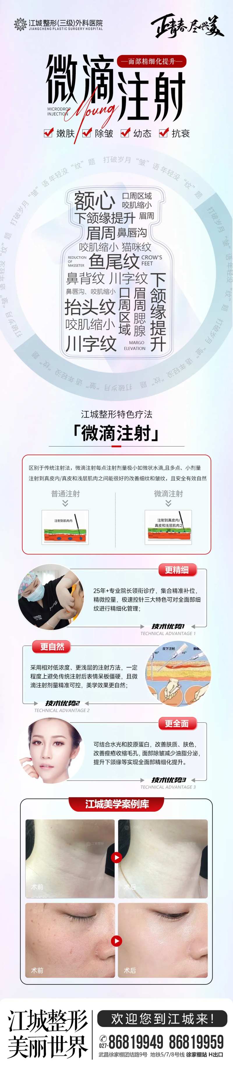 微滴注射                                                                                                                                                                                                    -采灵感-cailinggan.com