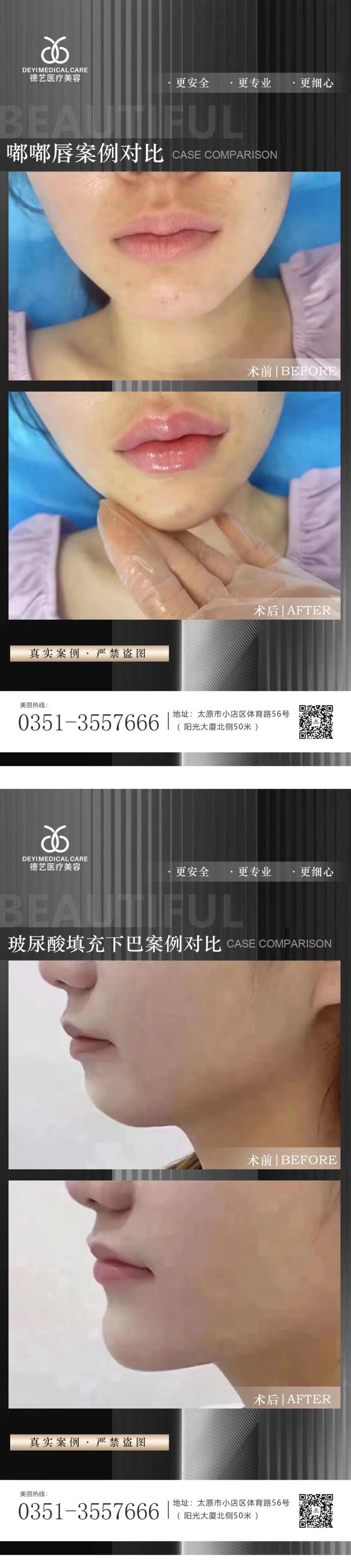 医美案例对比图-采灵感-cailinggan.com
