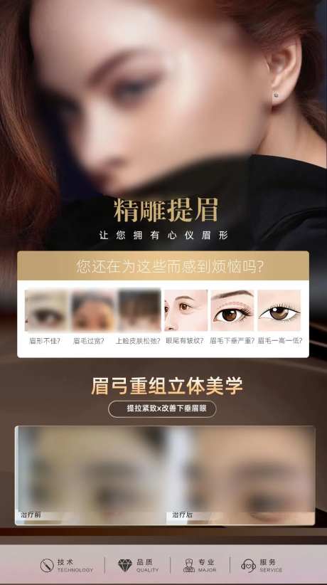 眉弓重塑-采灵感-https://www.cailinggan.com/