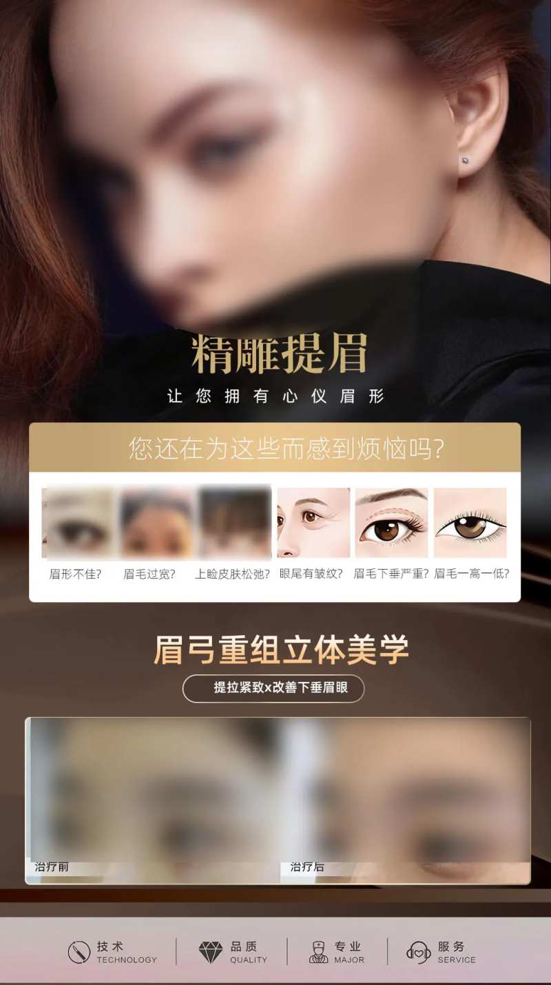 眉弓重塑-采灵感-cailinggan.com