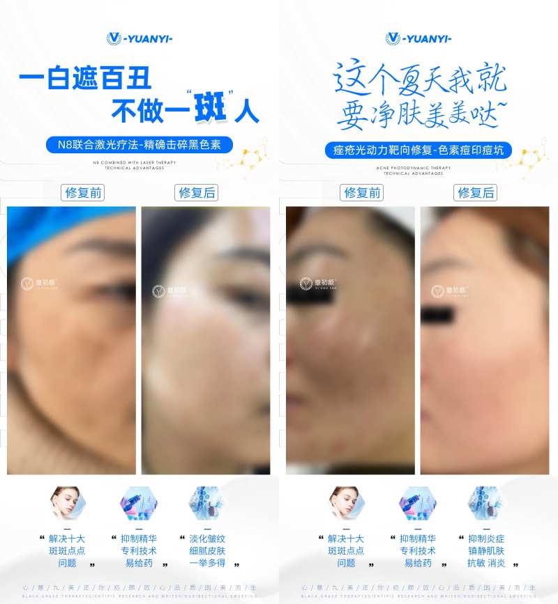医美护肤祛斑对比效果产品图-采灵感-cailinggan.com