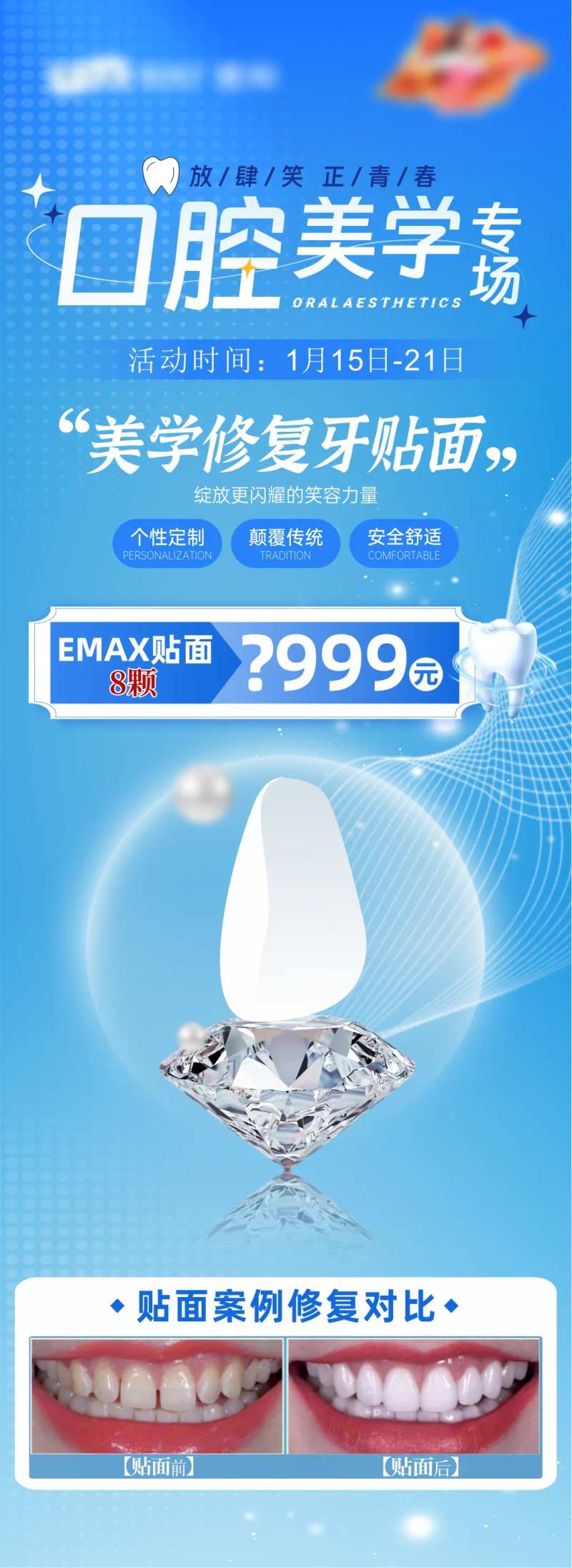 口腔美学牙贴面长图-采灵感-cailinggan.com