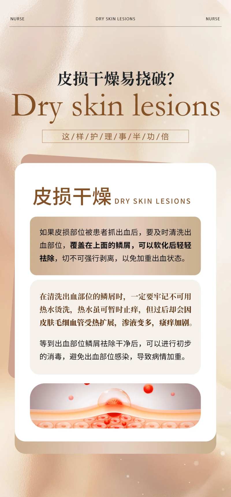 皮肤病常识海报-采灵感-cailinggan.com