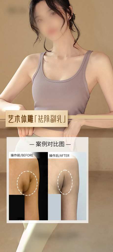 医美祛除副乳案例海报-采灵感-https://www.cailinggan.com/