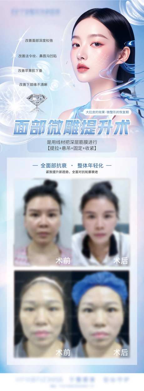 面部微雕-采灵感-https://www.cailinggan.com/