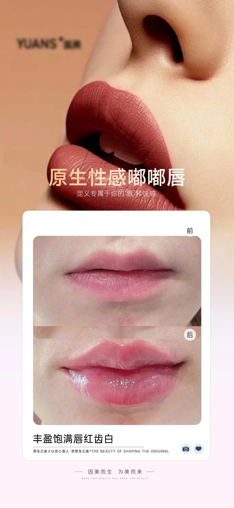 医美嘟嘟唇案例对比-采灵感-cailinggan.com