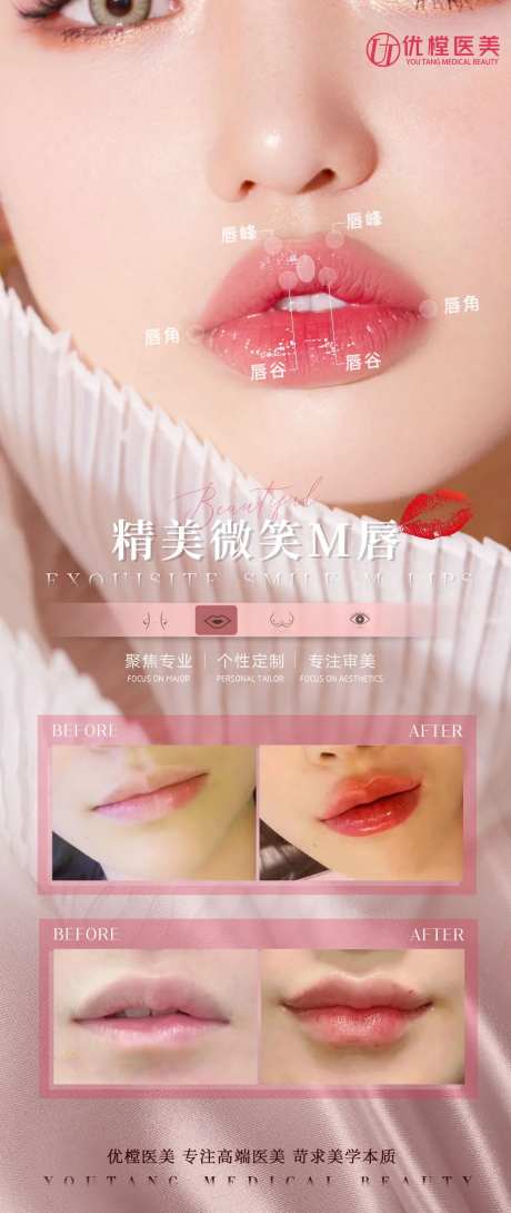 医美案例唇海报-采灵感-https://www.cailinggan.com/