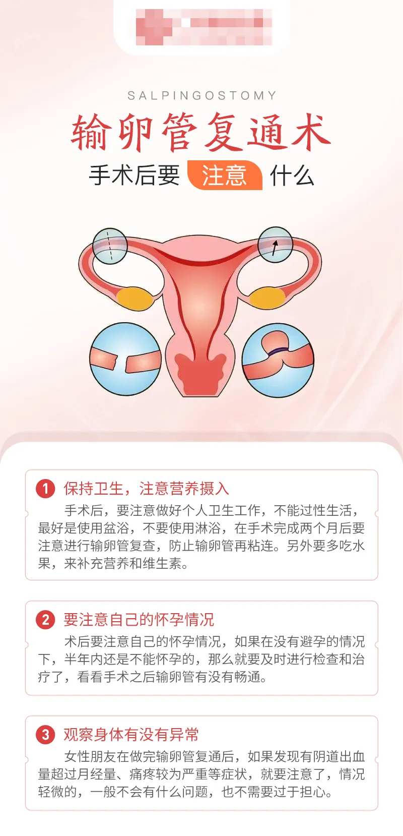 输卵管复通术后注意事项海报-采灵感-cailinggan.com