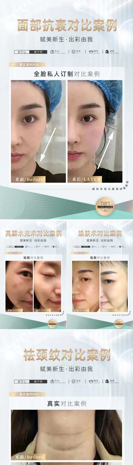 医美真实对比图-采灵感-https://www.cailinggan.com/
