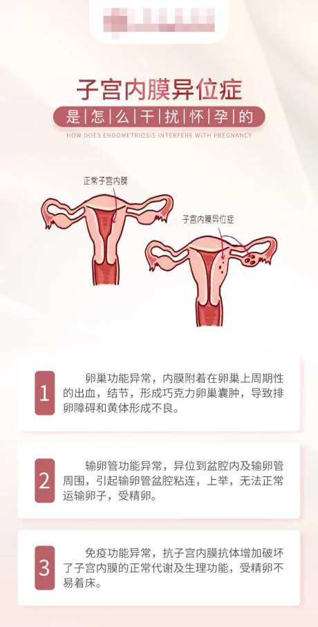 子宫内膜异位症海报-采灵感-https://www.cailinggan.com/