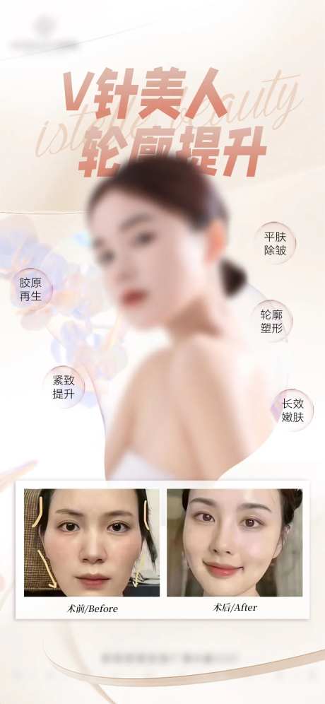 面部抗衰轮廓提升海报-采灵感-https://www.cailinggan.com/