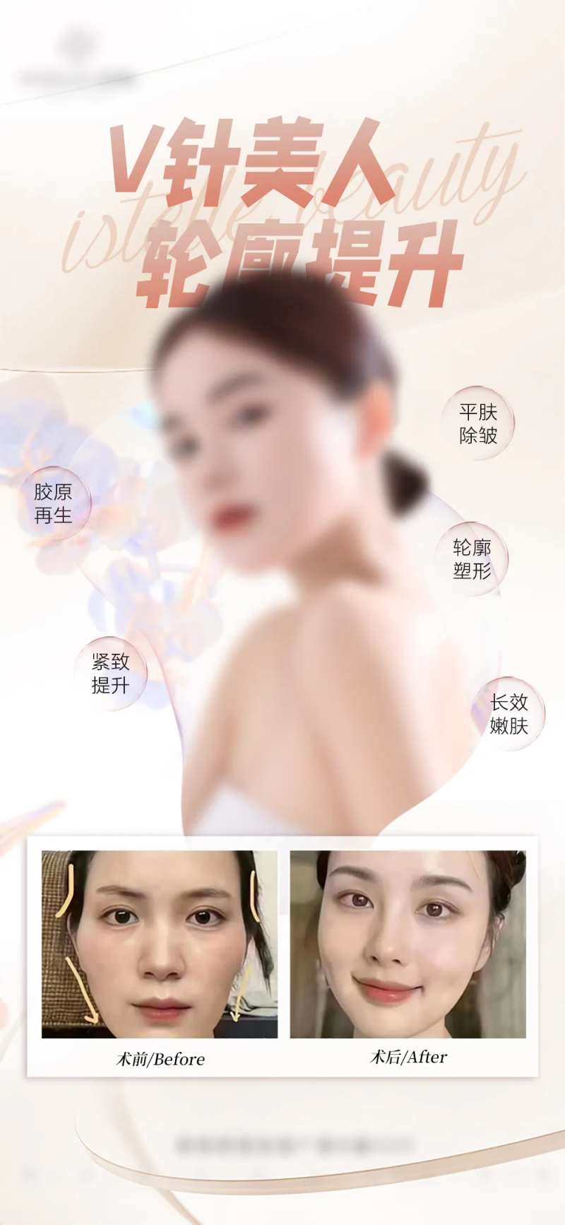 面部抗衰轮廓提升海报-采灵感-cailinggan.com