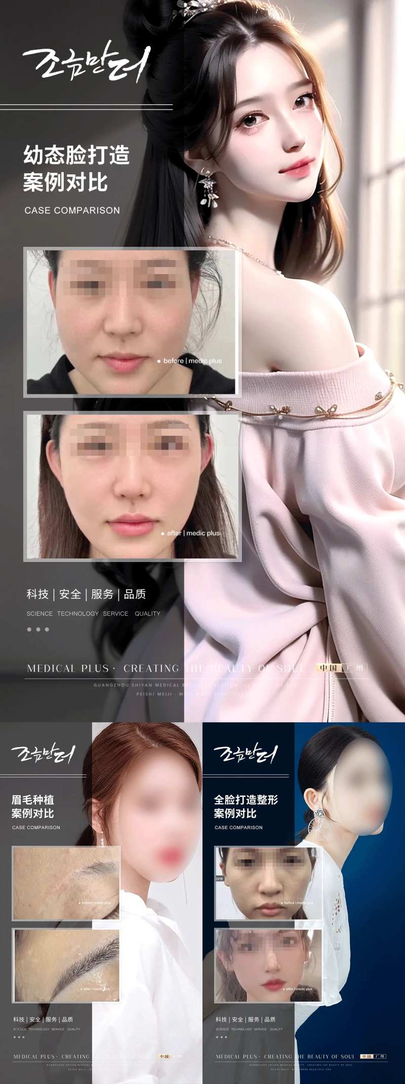 医美植发案例系列海报-采灵感-cailinggan.com