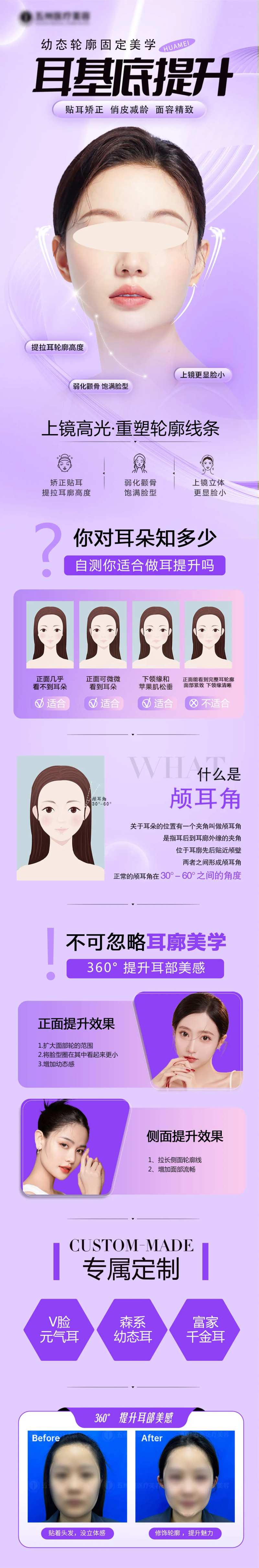 医美幼态耳-采灵感-cailinggan.com